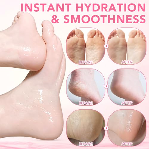 60% Urea Foot Care Stick with Salicylic Acid - Cracked Heels Relief