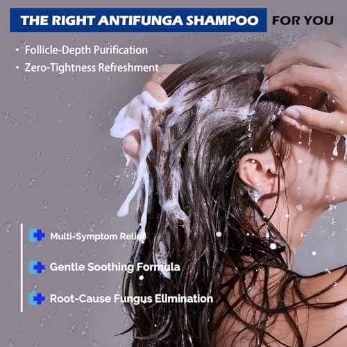 Antifungal Shampoo for Seborrheic Dermatitis, Folliculitis & Scalp Psoriasis, Anti-Dandruff Shampoo for Men & Women, Relieves Scalp Itching, Dryness, Sulfate & Paraben-Free, 10.1 Fl Oz