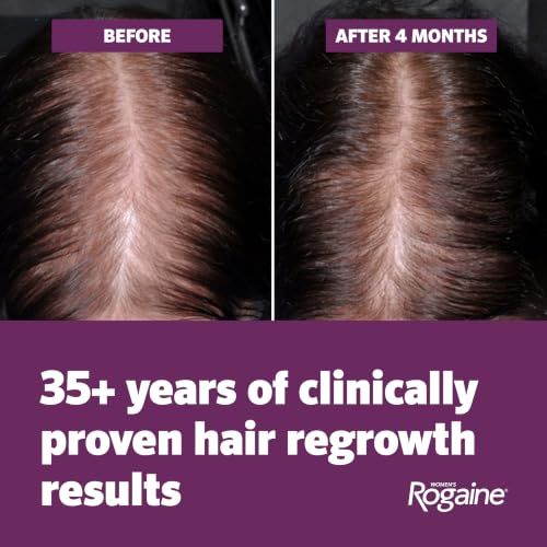 Women's Rogaine 5% Minoxidil Foam Hair Regrowth, 4-Month Supply
