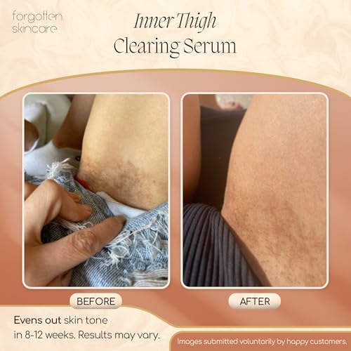 Forgotten Skincare Body Oil Serum - Hydrating Treatment to Soothe Razor Bumps, Ingrown Hair Treatment & Support Even Skin Tone