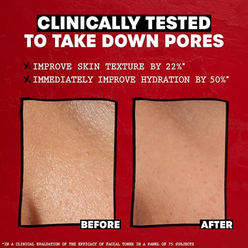 Thayers Alcohol-Free Rose Witch Hazel Toner 12oz