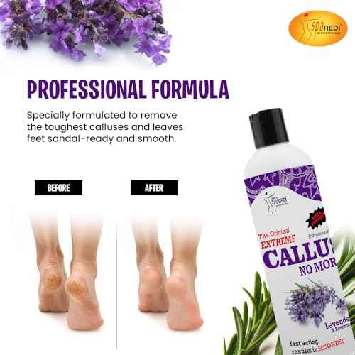 SPA REDI Callus Remover - Removes Toughest Calluses in Seconds and Smooths Dry Cracked Heels, Lavender & Rosemary - 12 Oz