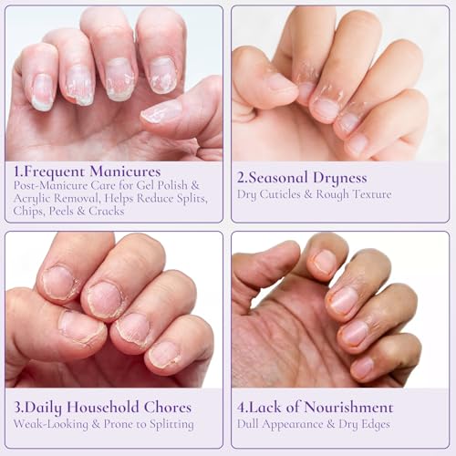 Nail & Cuticle Cream with Keratin & Biotin for Dry Cuticles - 0.5 fl oz