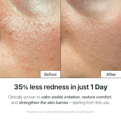 NDP Cica Cream - Gel Face Moisturizer for Sunburn Relief, lightweight Korean Moisturizer for Sensitive Skin, Centella Asiatica, Hydrating, Calming, Soothing (1.7 Fl oz / 50ml)