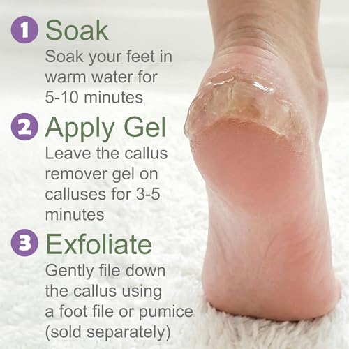 Extra Strength Foot Callus Remover Gel - 4oz Professional Formula for Softening Dead Skin