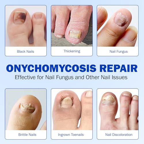 Toenail Repair Patches - 21 PCS Overnight Nail Treatment