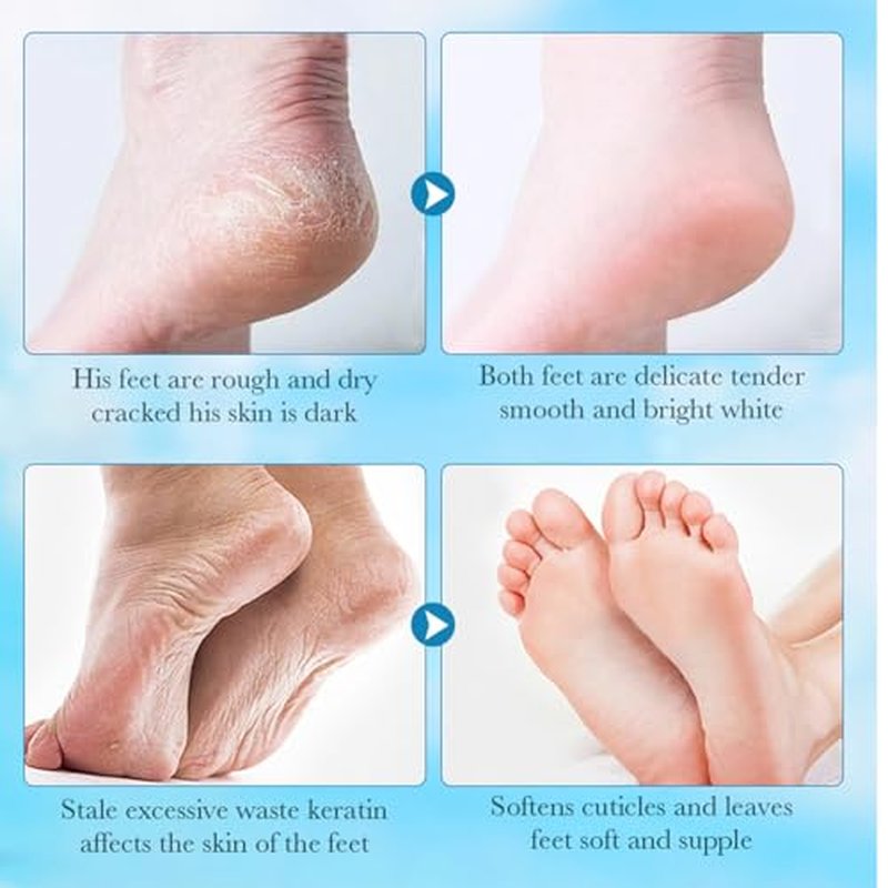 JoanofArc Foot Peeling Mask - Moisturizing Exfoliating Treatment, 4 Pack