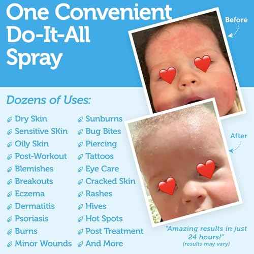 Happy Skin Hypochlorous Acid Spray for Face Travel Size ? Extra Strength Natural Full Body Cleansing Toner for Acne ? Soothe, Hydrate & Repair Dry, Sensitive Skin ? pH Balanced, Non-Toxic 2oz