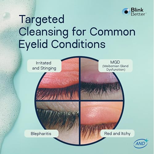 BetterLids Foaming Eyelid Cleanser ? Gentle Daily Foam for Eyelids, Eyelashe Wash & Face, Soothing Tea Tree Oil Formula with Ectoin & Centella, Non-Stinging, Preservative-Free, 2 fl oz