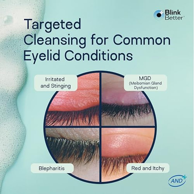 BlinkBetter Foaming Eyelid Cleanser – Gentle Daily Foam with Tea Tree Oil