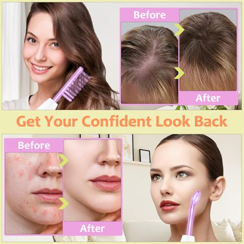 Uaike High Frequency Facial Wand - 4 in 1 Violet Handheld Device