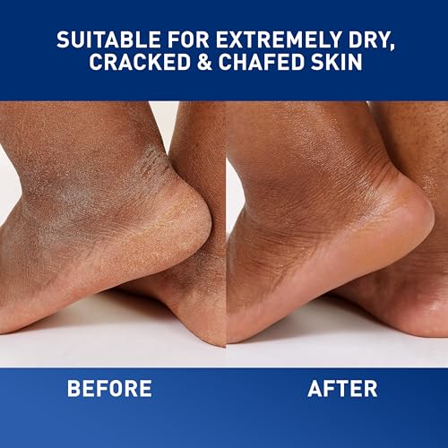 CeraVe Healing Ointment 12oz - Skin Protectant for Dry Skin & Eczema