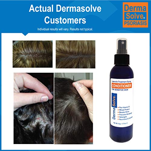 Dermasolve Psoriasis Leave-In Conditioner Spray for Sensitive Scalp