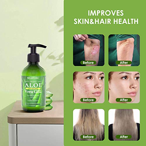 100% Pure Aloe Vera Gel - Face & Body Care
