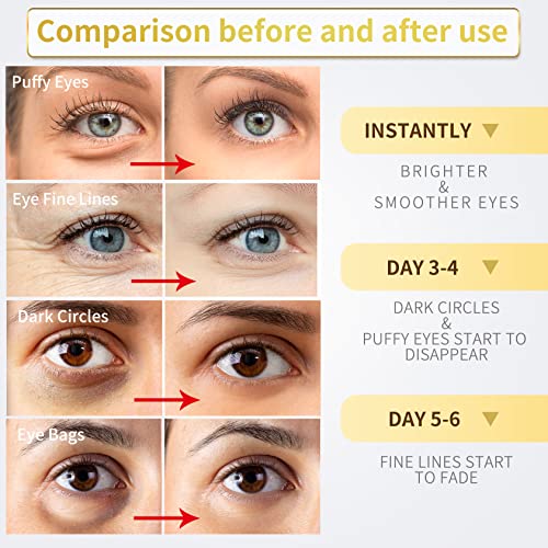 24K Gold Under Eye Patches - 60 Pack for Puffy Eyes, Dark Circles, Bags & Wrinkles with Collagen & Hyaluronic Acid - Eye Care Pads for Daily Skincare (Gold)