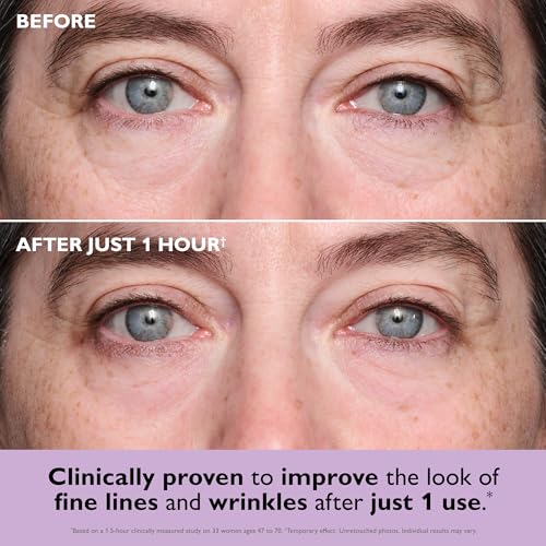 Peter Thomas Roth | Instant FIRMx¢ç Collagen Tightening Eye Patches | Eye Patches For Firming Under-Eye Bags & Wrinkles | Eye Masks For Puffiness