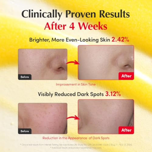 Vitamin C Brightening Serum with Niacinamide 4% & Hyaluronic Acid