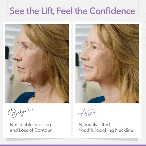 Face Lift Strips - Instant Jawline & Neck Lift Tape, 25 Ct
