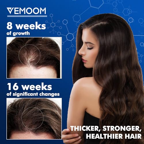 5% Minoxidil Hair Growth Spray for Women & Men - 60ml, Extra Strength Treatment for Thicker, Stronger Hair