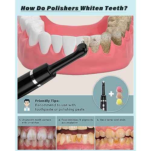 Tooth Polisher, Rechargeable Tooth Whitening Kit for Teeth Cleaning and Whitening, with 3 Tooth Polish Paste and 5 Brush Heads, LED Light, Easy to Use at-Home Personal Dental Care Kit (Black)