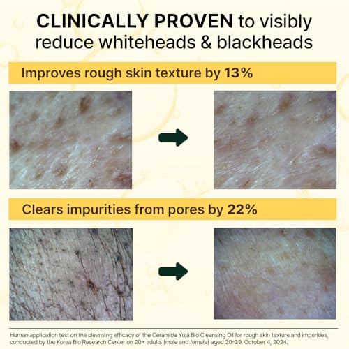 Ceramide Yuja Cleansing Oil (200ml) ? Deep Pore Cleansing, Hydrating with Yuzu & Ceramide, Non-Comedogenic, Removes Waterproof Makeup, Ideal for Acne-Prone Skin (6.76oz)