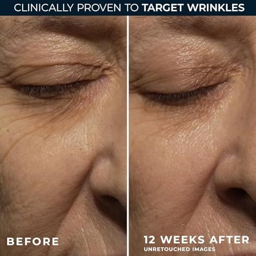 RoC Retinol Correxion Deep Wrinkle Night Cream 0.5oz
