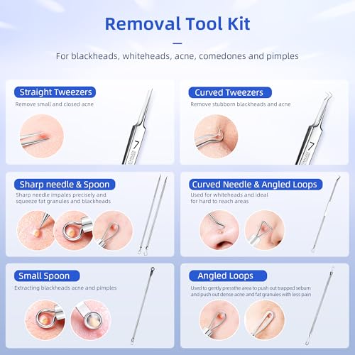 7-Piece Blackhead Remover Tool Kit | Stainless Steel Acne Extractor