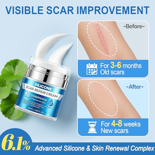 Scar Cream 6% Dimethicone Silicone Cream for Scars, Advanced Scar Removal Cream for Surgical, C-Section, Acne, Keloids, Burns, Old & New Scars, with Scar Tape, 1.69 fl.oz + 1.5m