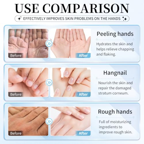 AIUEO 10 Pairs Moisturizing Hand Mask Gloves for Dry Cracked Hands