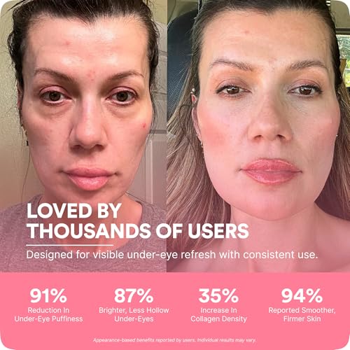 BOTANIQUE PARIS RevitalEyes Under Eye Red Light Therapy & Cream