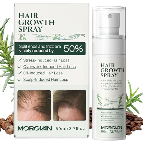 Morovan Hair Growth Spray - Batana & Castor Oil, 2.7 fl oz