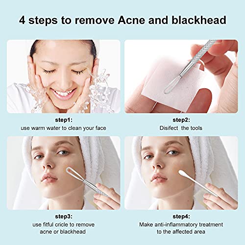 La Chat Blackhead Remover - 2-in-1 Pimple Extractor Tool