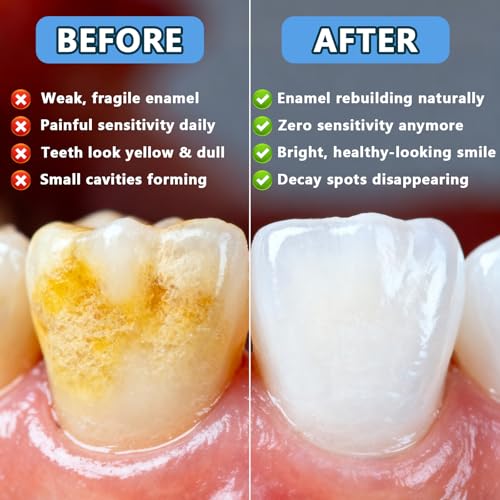 GFG Nano Hydroxyapatite Toothpaste 2pcs - Natural Fluoride-Free Remineralizing & Sensitive Care