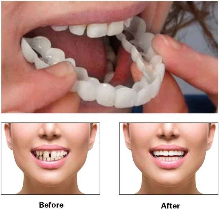 ‌2 Pairs Natural-Looking Temporary Smile Solutions, Top & Bottom Adjustable for Comfortable Experience (1.0)
