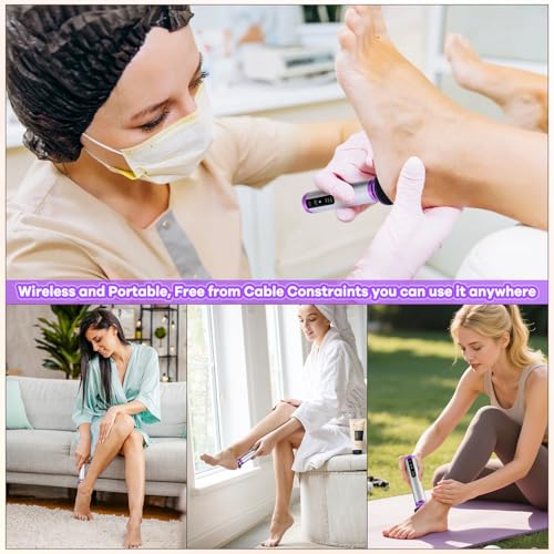 Electric Foot Callus Remover - Rechargeable 3-Speed File