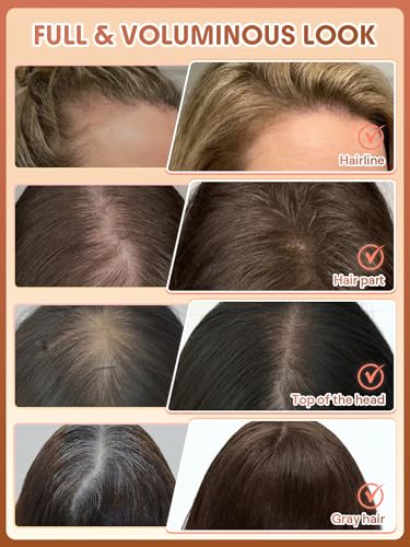 Dark Brown Hair Building Fibers 15g for Thinning Hair Volume Boost - Instant Fuller Hairline