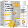 Psoriasis Shampoo for Dry Itchy Scalp with Salicylic Acid 3% - Eczema Relief & Folliculitis Treatment