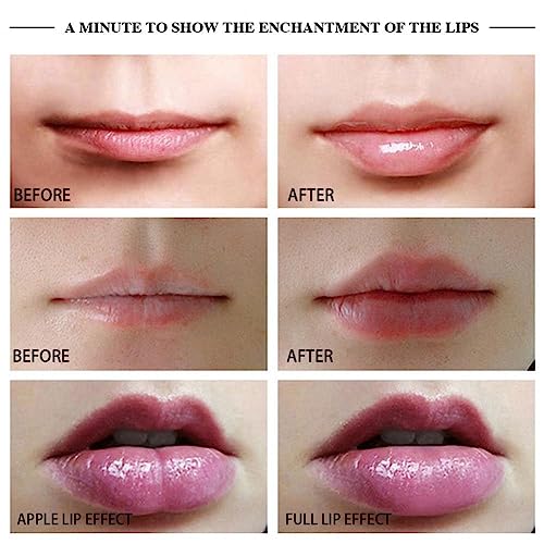 Silicone Electric Lip Plumper Tool for Fuller Lips