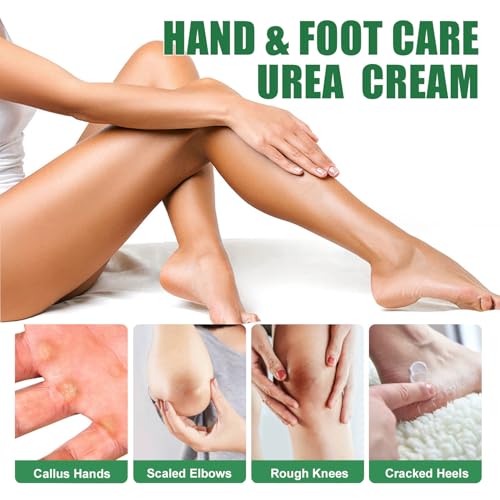60% Urea Foot Cream for Cracked Heels with Salicylic Acid
