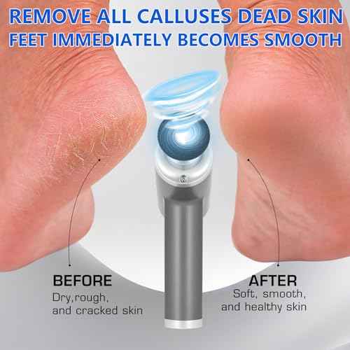 Upgraded Electric Callus Remover for Feet 4500rpm, Professional Electric Foot Callus Remover Foot Sander Pedicure File with 2 Interchangeable Heads and Replaceable Sandpaper Discs