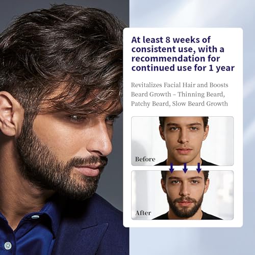 Men's 5% Minoxidil Hair Regrowth Spray – Biotin & Rosemary