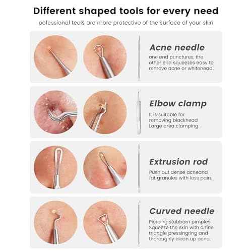 Pimple Popper Tool Kit - Boxoyx 6 Pcs Pore Prep Blackhead Remover Comedone Extractor Kit with Box for Quick and Easy Removal of Pimples, Blackheads, Zit Removing, Forehead,Facial and Nose (Silver)