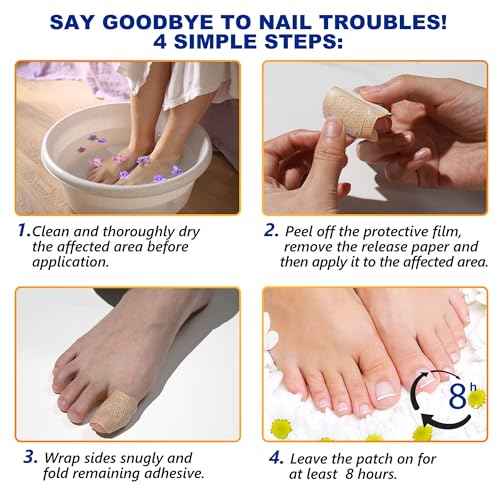 Nail TreatmentFungal Nail Patches For Toenails 32patches, Restore The Nails¡¯ Natural Strength And Clarity.