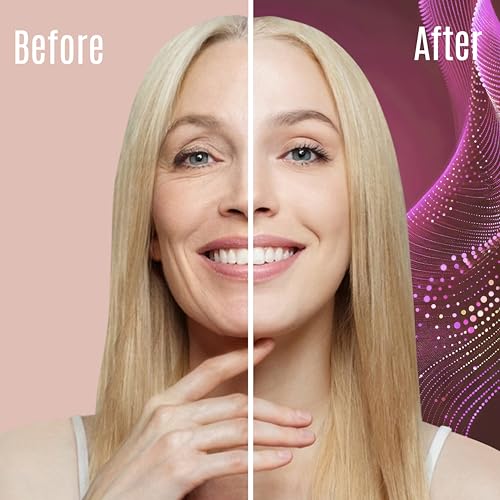 Retinol Cream ? 3% (Percent) Retinol Cream for Face with Hyaluronic Acid ? Anti-Aging Face Cream for Fine Lines and Wrinkles ? Hydrating Face Moisturizer with Shea Butter, Aloe Vera