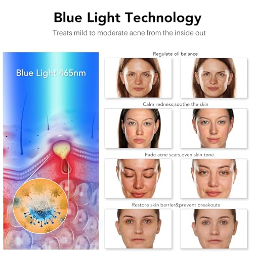 NEWKEY Blue Light Therapy Mask for Acne - Full Face LED Treatment