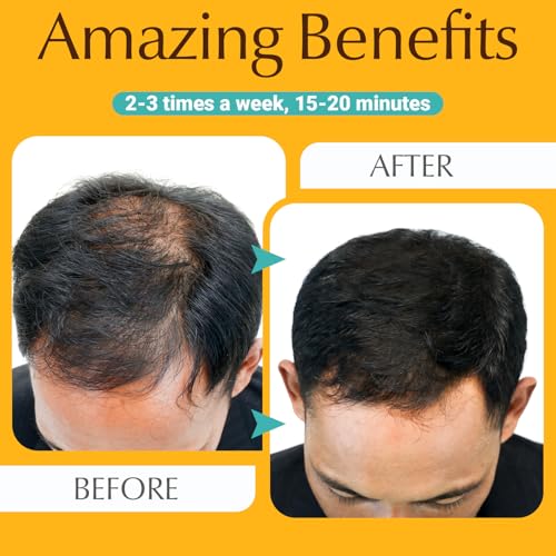 Hair Growth Comb