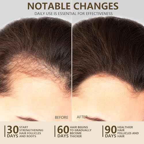 100% Natural Raw Batana Oil for Hair Growth, Unrefined & Organic Dr Sebi Hair Growth Oil From Honduras, Prevents Hair Loss, Eliminates Split Ends, Enhances Thickness 4.23 Fl Oz (Pack of 1)