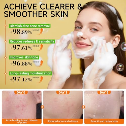 15 PCS Turmeric Skin Care Set - Turmeric Skin Care Kit Long-Lasting Moisture, Oil Control & Smooth Skin - With Cleanser, Soap, Scrub,Toner, Face Oil, Eye Cream, Lotion, Cream & Facial Masks