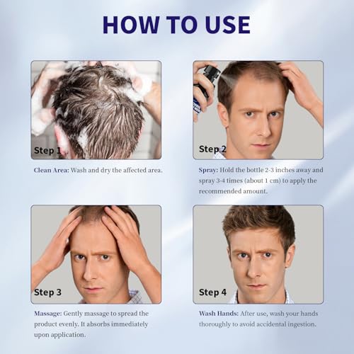 Men's 5% Minoxidil Hair Regrowth Spray – Biotin & Rosemary