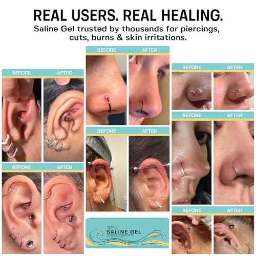 Base Labs Saline Gel 1.5oz ? Piercing Aftercare & Piercing Bump Solution ? Nose, Ear & Belly Button Piercing Care ? Hydrating Gel for Piercings, Burns & Irritations ? Aloe Vera, Tea Tree & Sea Salt